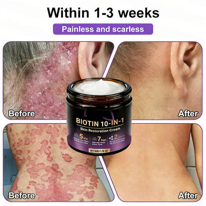 👨‍⚕️✨Made and Shipped from USA ✨Biotin 10-in-1 Skin Restoration Cream