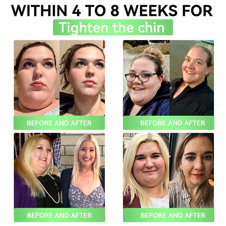 🔥Vilnexa™ Moringa × AMPK 8-Benefit Slimming & Metabolic Nano Microneedle Patch 🇺🇸  Just once a day · Visible changes in 7 days