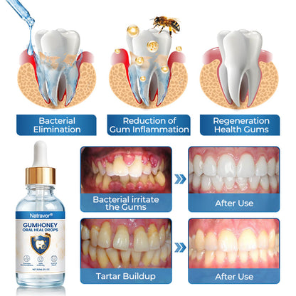 Natravor® GumHoney Oral Repair Drops