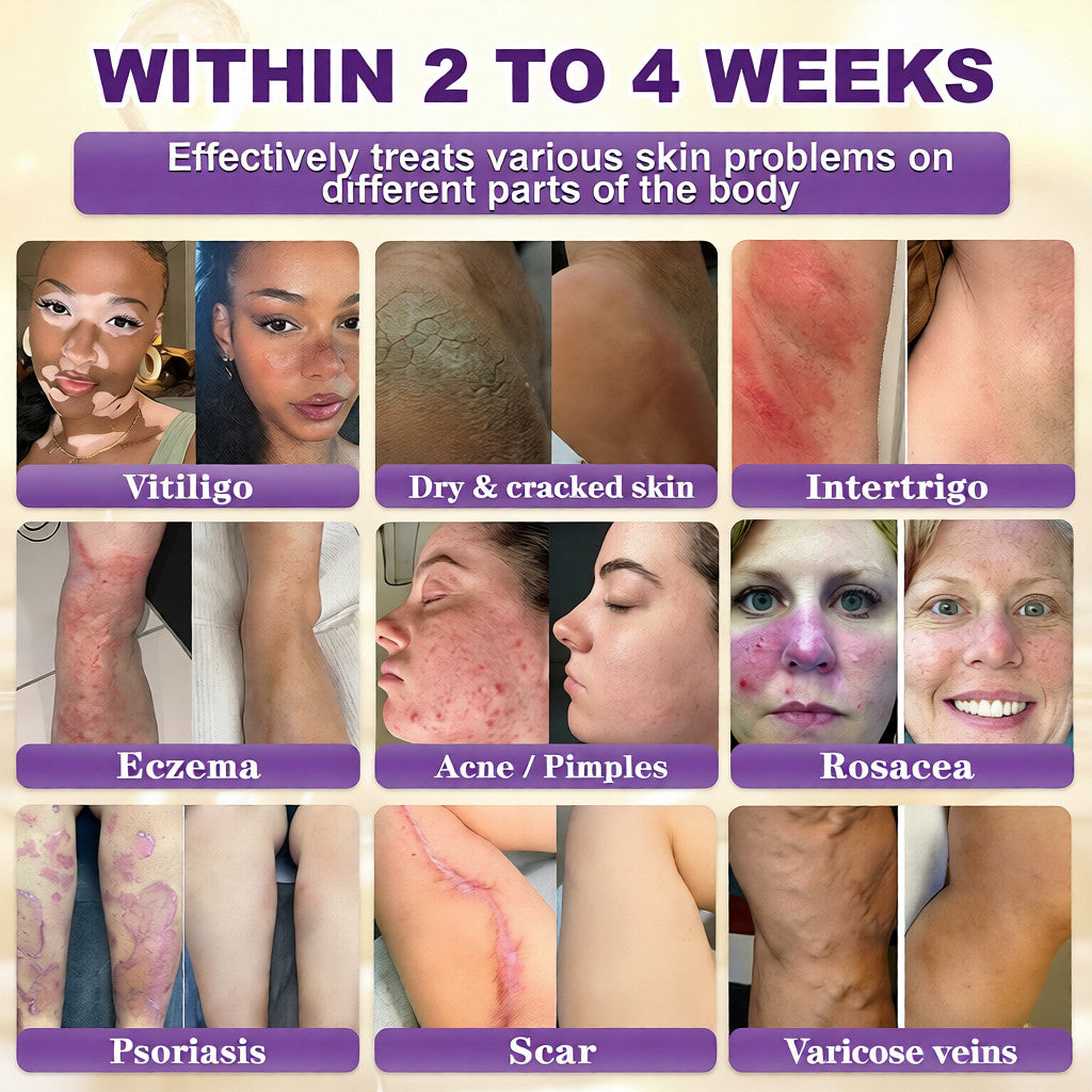👨‍⚕️✨Made and Shipped from USA ✨Biotin 10-in-1 Skin Restoration Cream