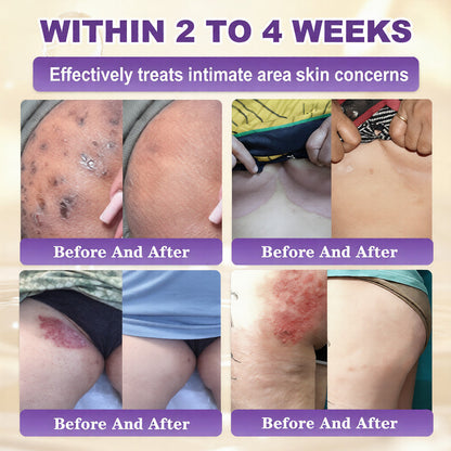 👨‍⚕️✨Made and Shipped from USA ✨Biotin 10-in-1 Skin Restoration Cream