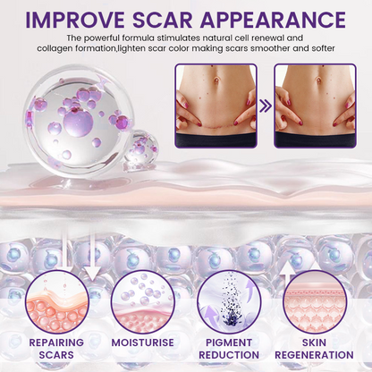 Natravor® ReGenScar Stem Cell Scar Gel