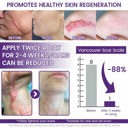 Natravor® ReGenScar Stem Cell Scar Gel