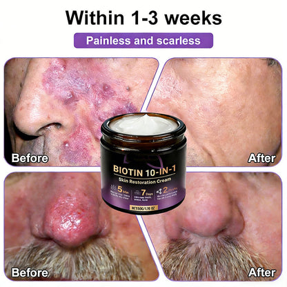 👨‍⚕️✨Made and Shipped from USA ✨Biotin 10-in-1 Skin Restoration Cream