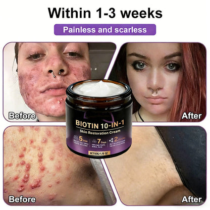 👨‍⚕️✨Made and Shipped from USA ✨Biotin 10-in-1 Skin Restoration Cream