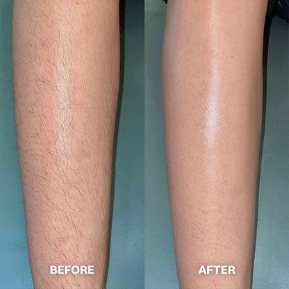 Hair Removal Cream for All Women & Men