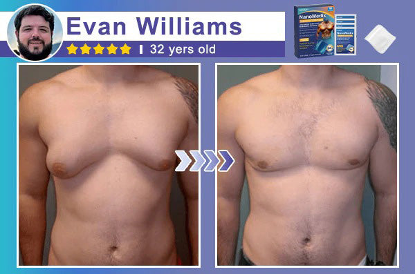 ⚕️💙Natravor® Gynecomastia Chest Fatburn & Firm Patch